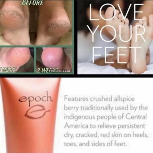 𝔻𝕠 𝕪𝕠𝕦 𝕤𝕦𝕗𝕗𝕖𝕣 𝕗𝕣𝕠𝕞 𝕤𝕠𝕣𝕖 𝕔𝕣𝕒𝕔𝕜𝕖𝕕 𝕙𝕖𝕖𝕝𝕤? - Picture 2 of 5